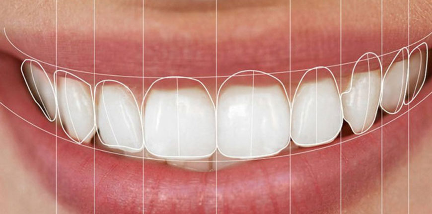 digital-smile-clinica-odontoiatrica-giordano