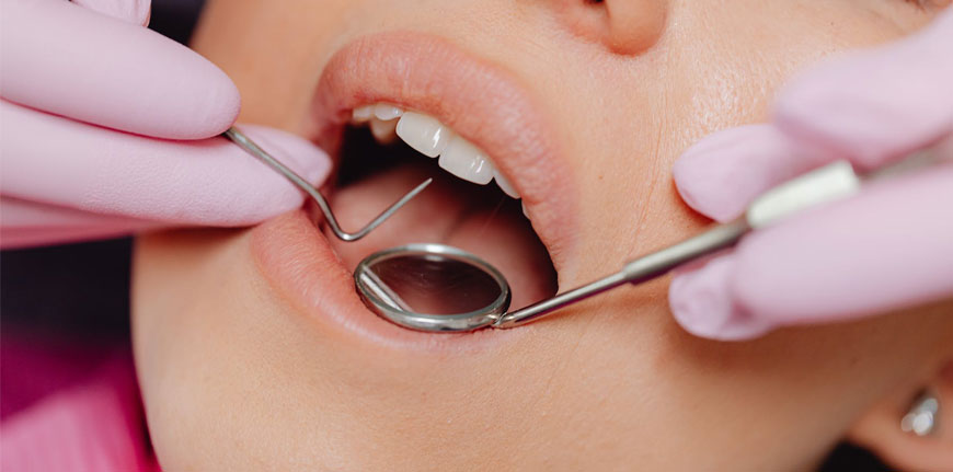 odontoiatria-conservativa-clinica-odontoiatrica-giordano