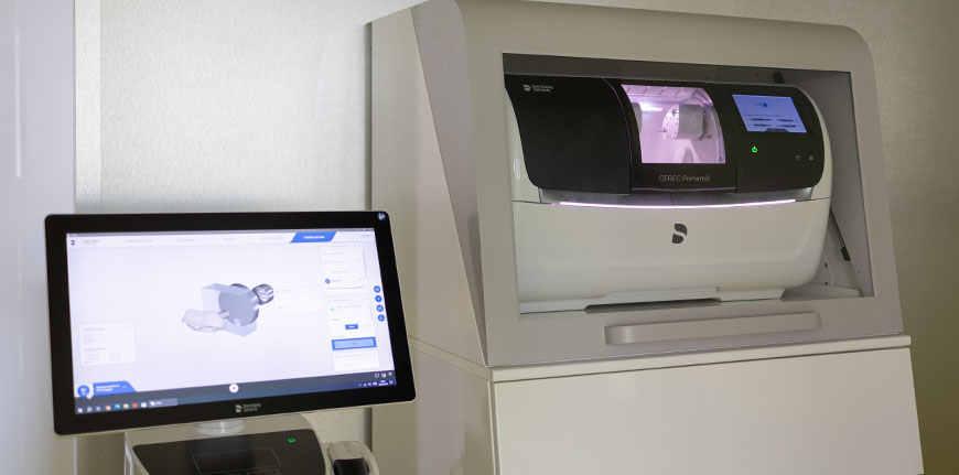 impronta-digitale-clinica-odontoiatrica-giordano